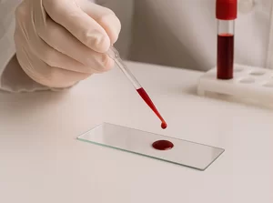 Что такое группы крови и как они определяются: разбираемся с Дезнэт