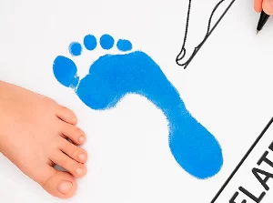 Плоскостопие: причины, симптомы, диагностика и лечение